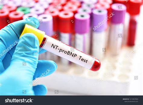 nt probnp blood test colour bottle|nt probnp b type.